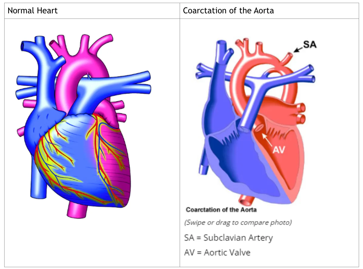 Starting from a basic script and some images, we developed an animated heart which patients could grab and hold.
